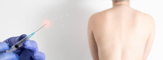 Facet Injections for Joint Injuries After an Auto Accident