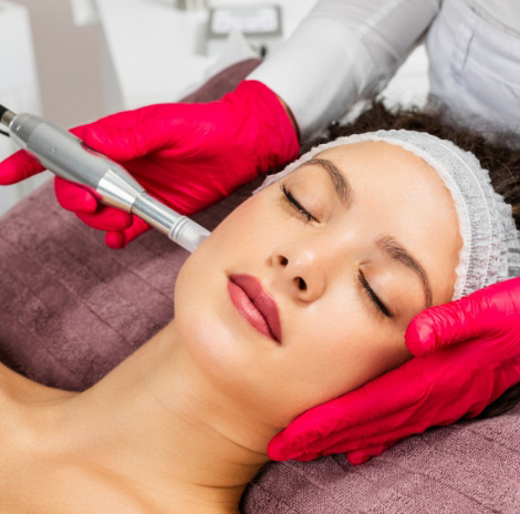 Microneedling 1