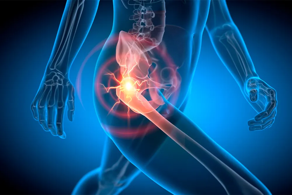 Hip Pain