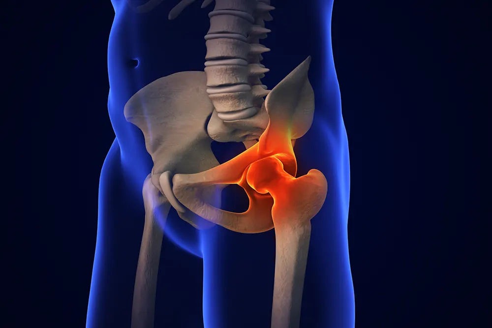 Hip Pain