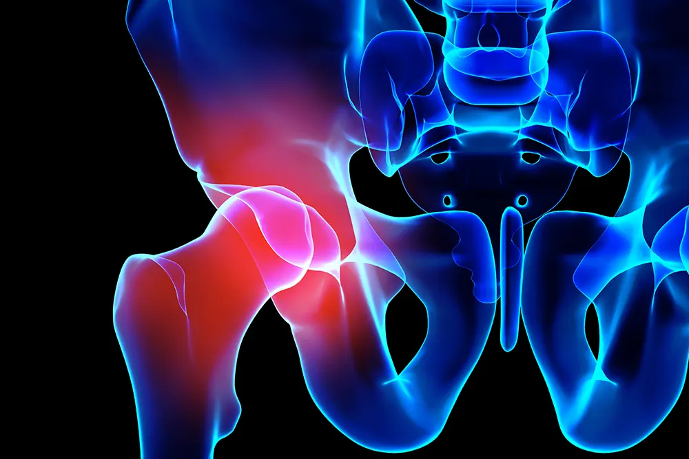 Hip Pain