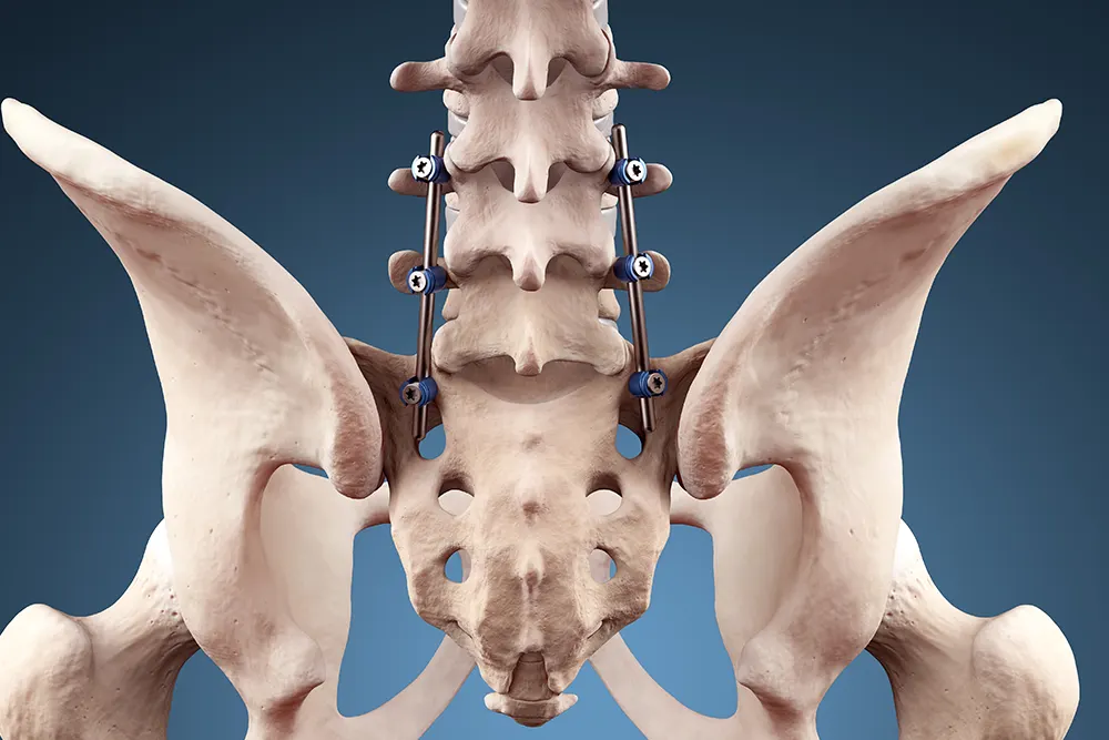 Lumbar Spine