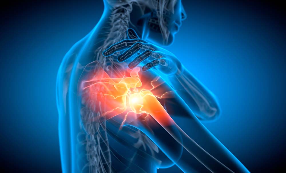 Shoulder Pain