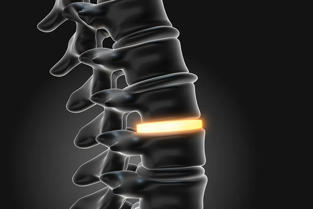Spine