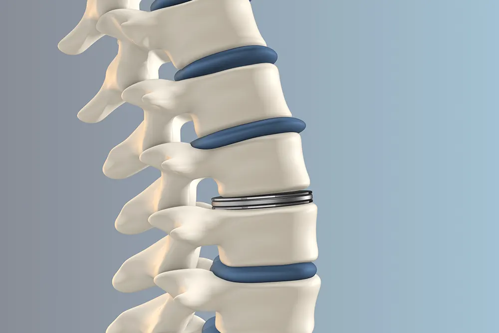 Spine